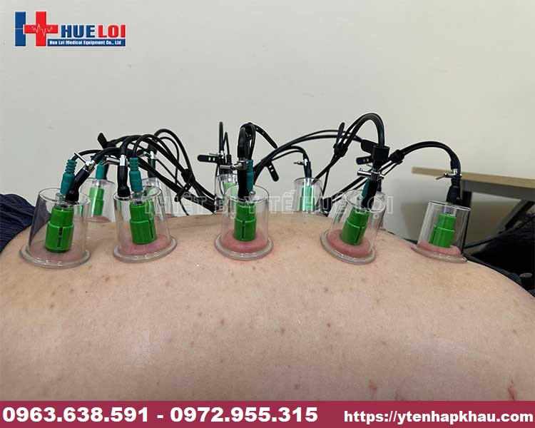 dien-cham-ket-hop-giac-hut-may-dien-cham-khong-kim